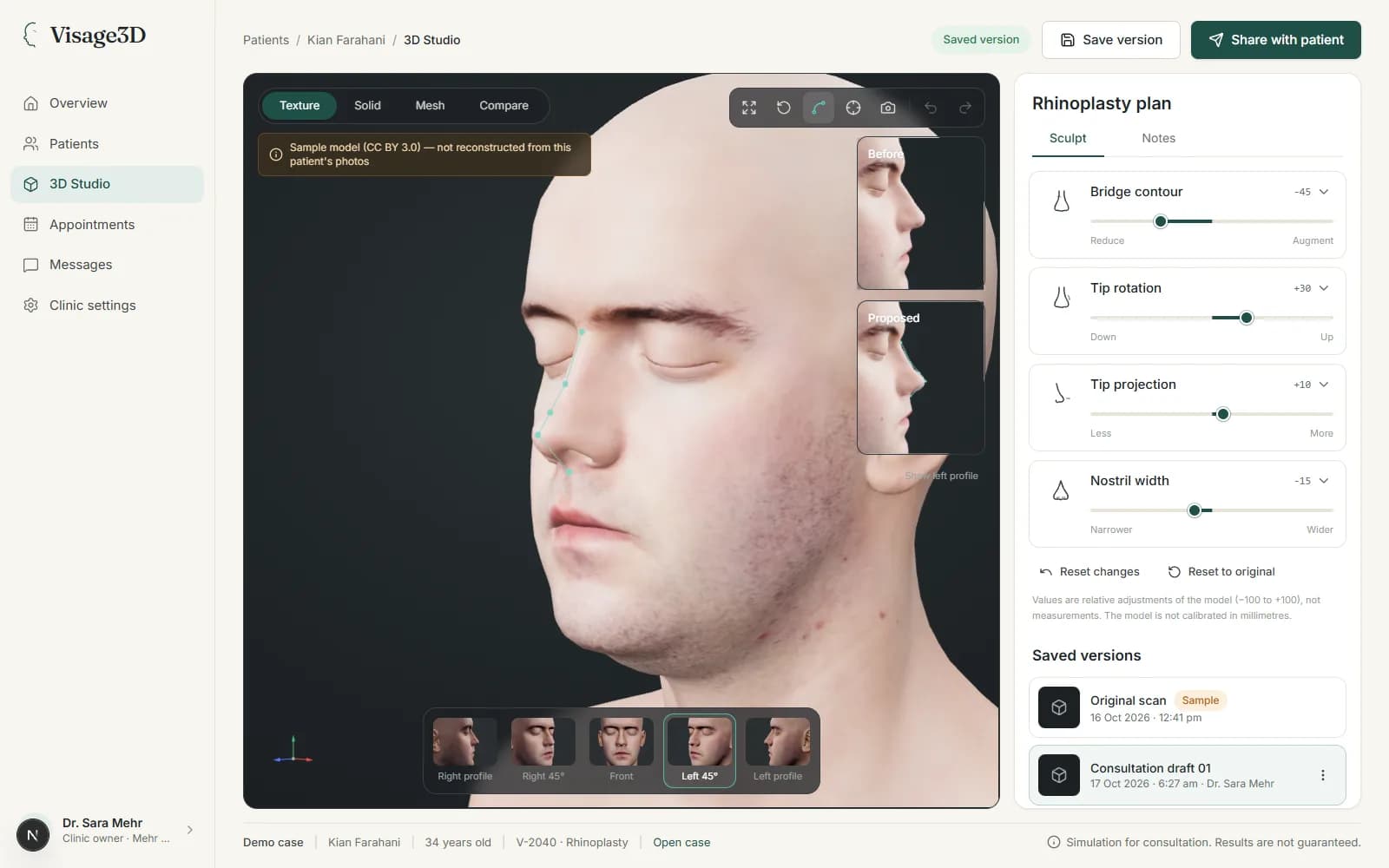 The Visage3D 3D Studio with a sample head model and rhinoplasty controls